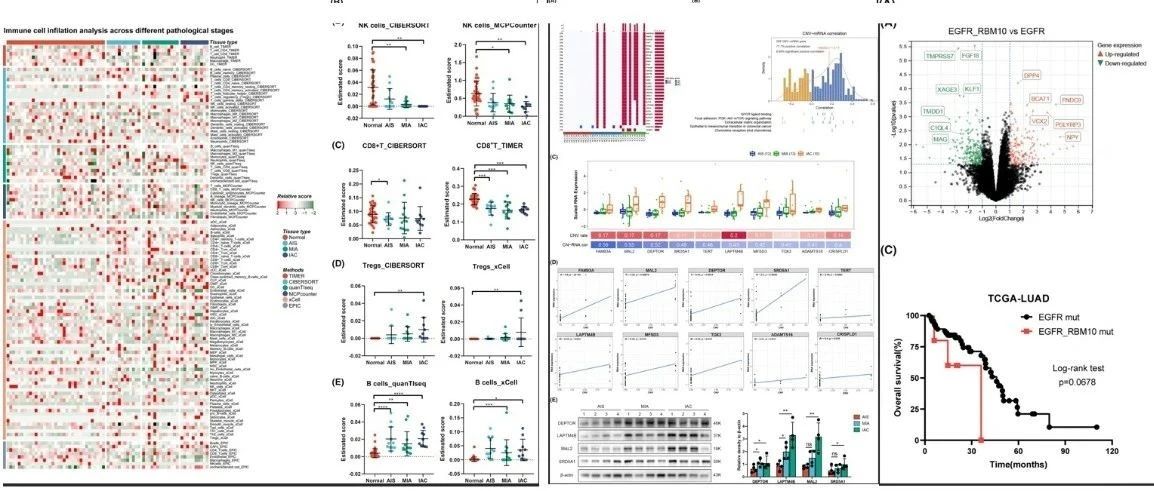 跟着SCI学转录组分析|整合全外显子组和转录组测序揭示磨玻璃结节型肺腺癌从癌前病变到浸润癌的动态演变