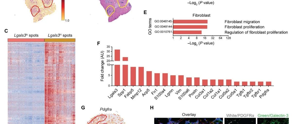 🤩 Journal Club | 单细胞与空间转录组学揭示骨骼肌纤维化中的关键巨噬细胞亚群