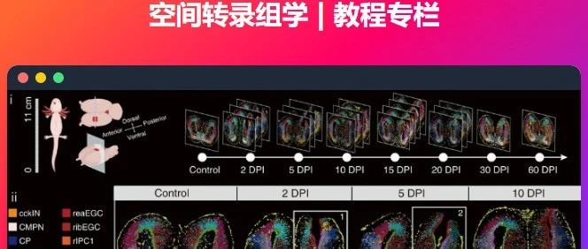 空间转录组：从R导入数据