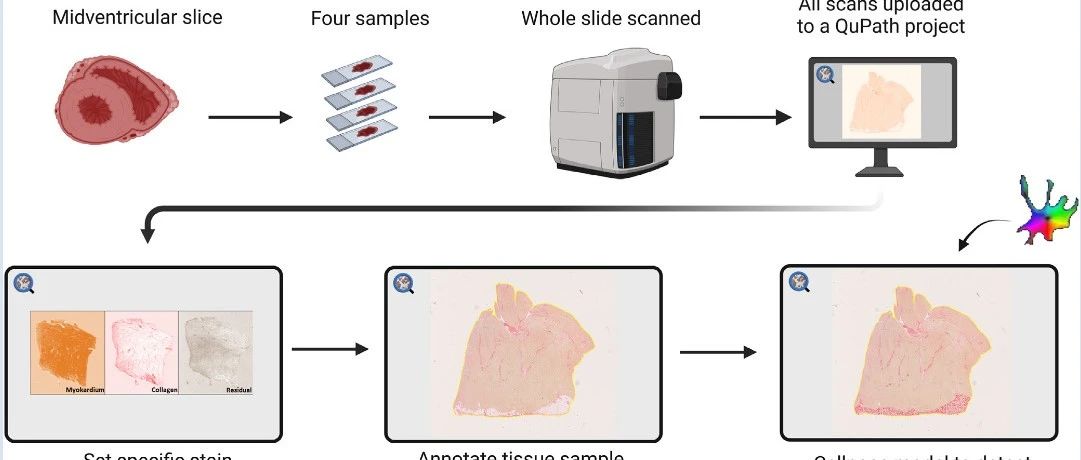 心脏解剖“黑科技”：用 QuPath + Cellpose 数出心里的“脂肪与纤维”