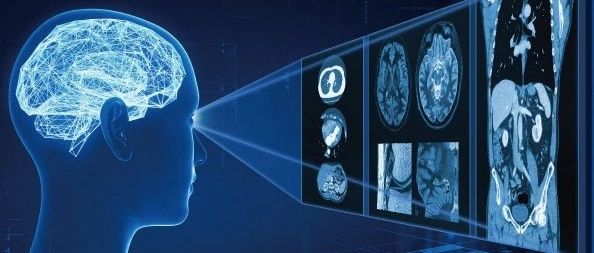 Nat. Commun. | AI写的CT报告能骗过真医生？BrainGPT诊断准确率超七成