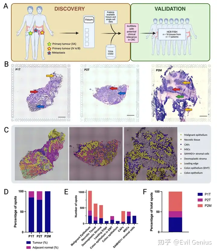 单细胞空间转录组学分析lncRNAs