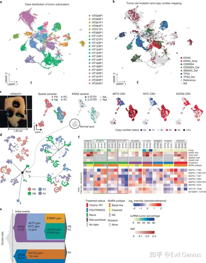 microenvironment in untreated and chemo