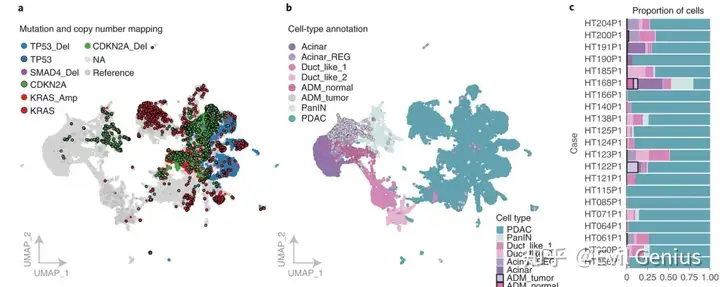 microenvironment in untreated and chemo