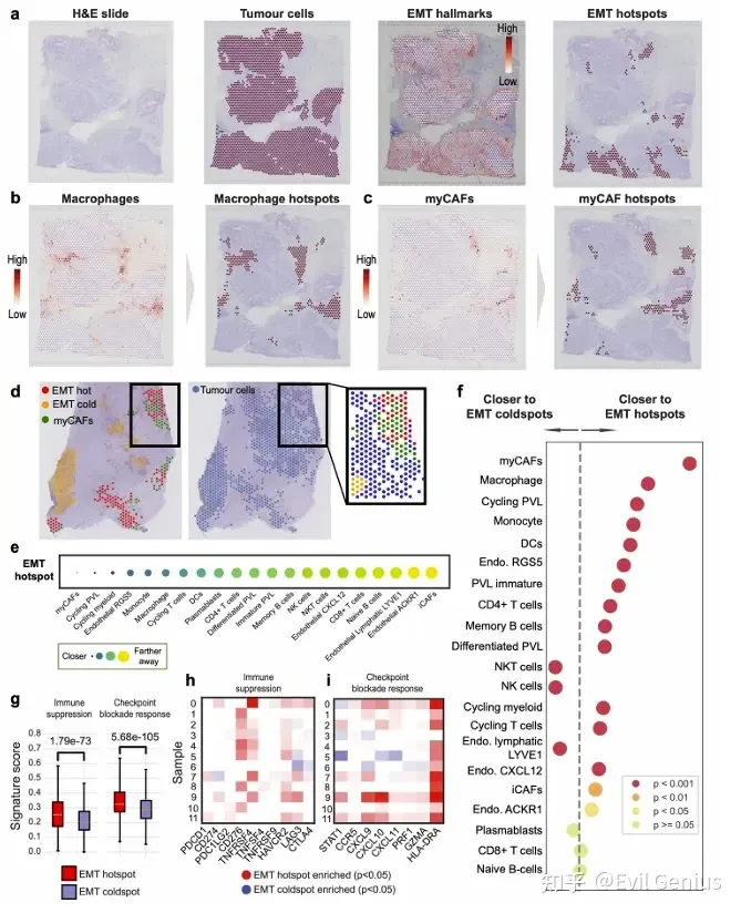 The spatial interplay between EMT progression and the TME