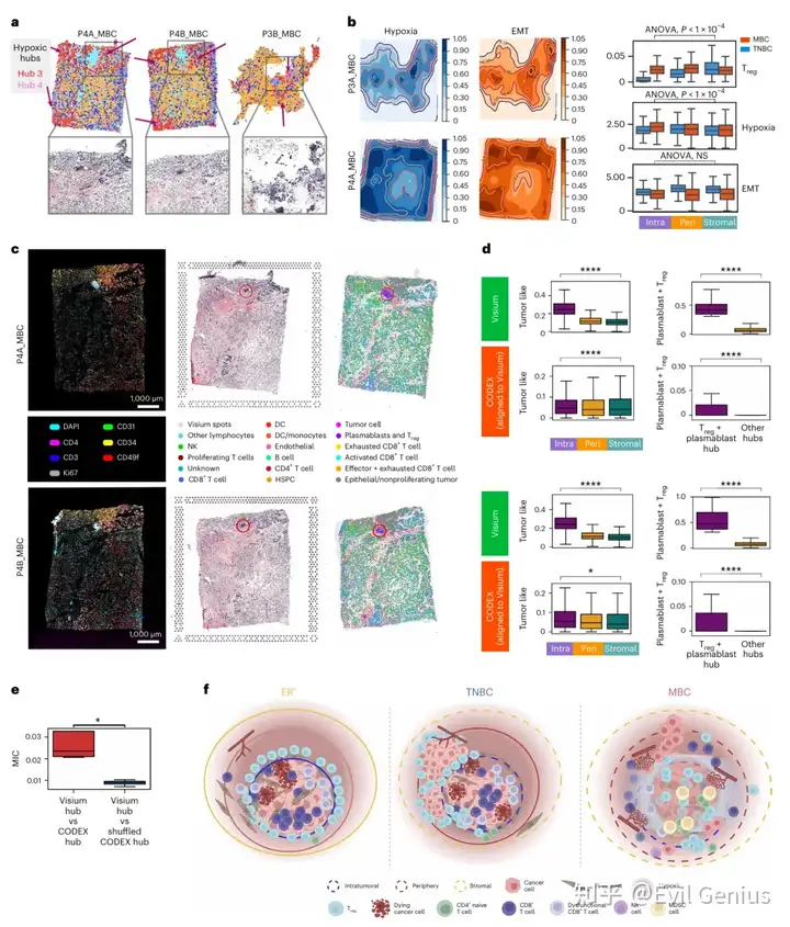  Spatial heterogeneity of the stromal breast TME