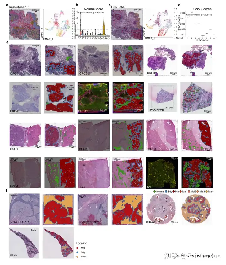 Delineating the tumor boundary