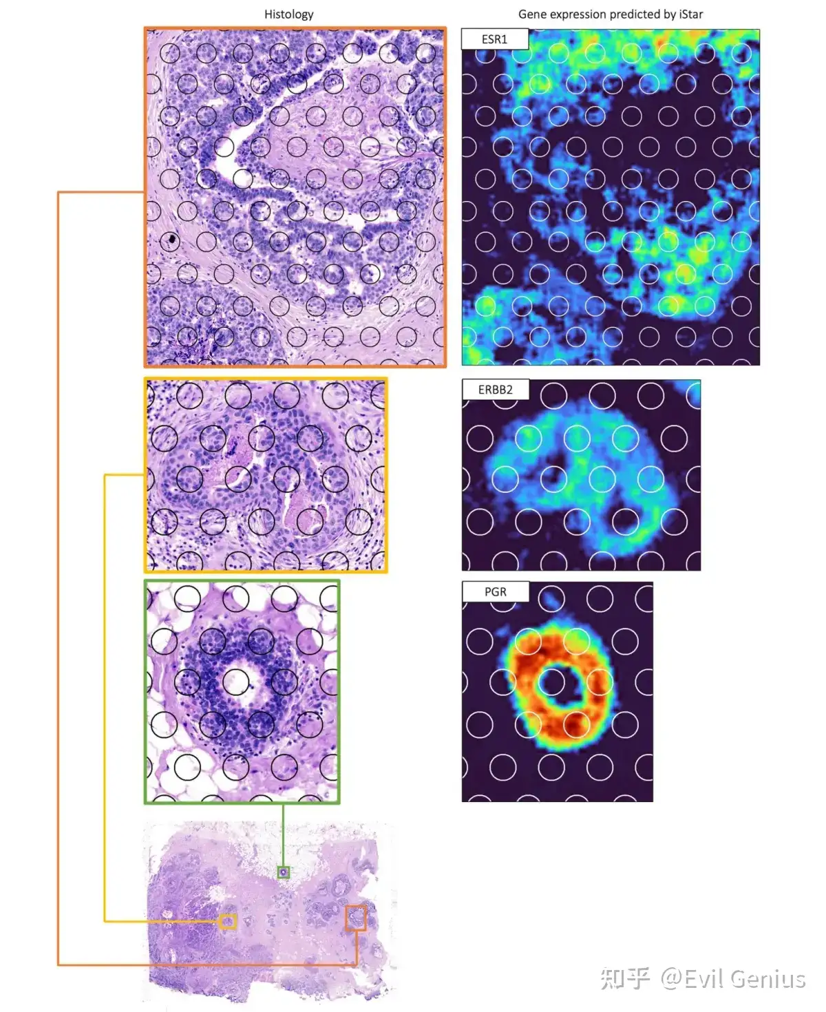 Correlation between super-resolution gene expression and histology