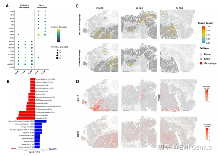 Identification and localization of two macrophage subpopulations in the tumor microenvironment.