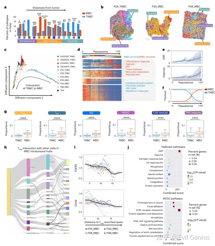 Intratumoral inflammation and heterogeneity in MBC epithelia