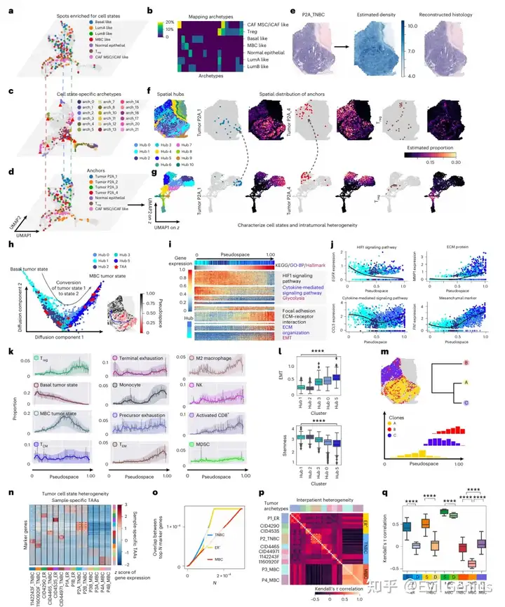  Characterizing spatial tumor heterogeneity in breast carcinoma