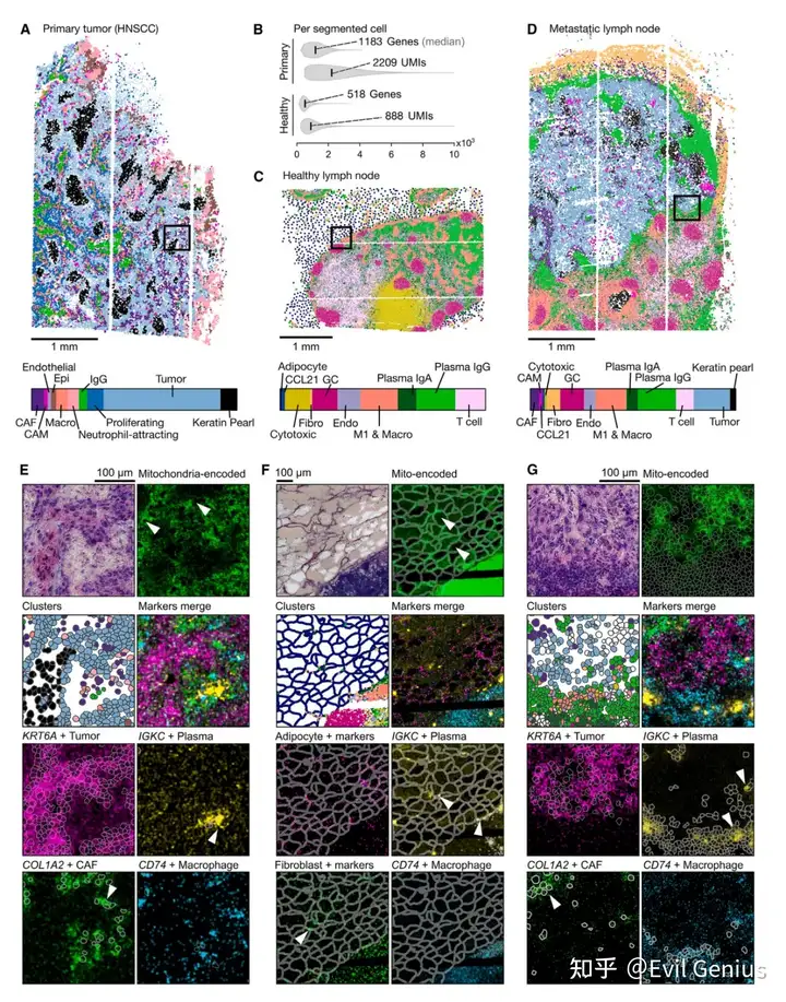 Open-ST accurately dissects cell-type complexity in primary human tissues