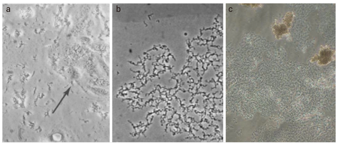 图 3. 分歧杆菌污染的细胞[3]