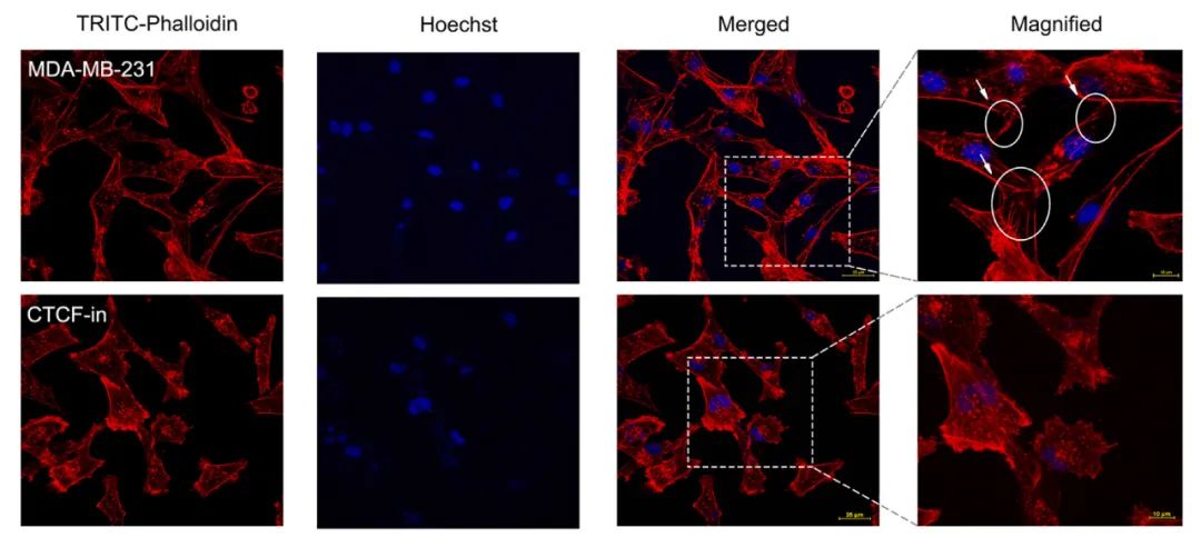 图 2. MDA-MB-231 细胞、CTCF-in 细胞的细胞骨架[2]