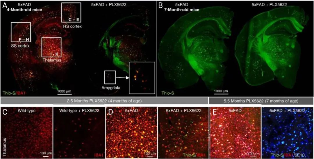 图 3. 小胶质细胞的清除伴随 5xFAD 小鼠的致密斑块的消失[3] A-B. 喂食 10 周 或者24 周后，皮质层丘脑区域的小胶质细胞数目于致密斑块数目的变化 C-D. AB 图丘脑区域细胞数目变化的放大图