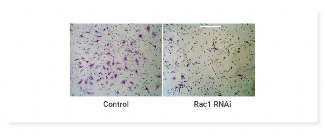 图 7. Transwell 侵袭实验中 Rac1 siRNA 抑制 SNB19 细胞通过 Matrigel 的侵袭[11]。 