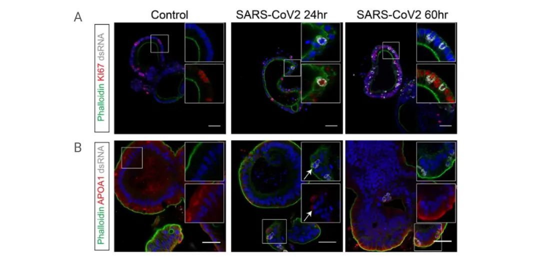 图 5. SARS-CoV-2 感染 hSIO 的共聚焦分析[12]