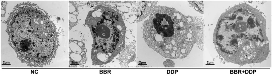 图 3. BBR 和 DDP 诱导下 OVCAR3 细胞的凋亡形态[2]