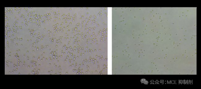 图 3. HT-1080 细胞铺板 1 h 内拍照。  密度太大（左）和密度太小（右）