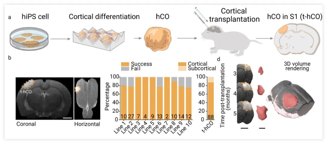 图 4. 在发育中的大鼠皮质中移植人类皮质类器官[4] a. 实验设计原理图。b. 移植2个月后 S1 区 t-hCO 的 MRI 图像。c. hiPS 细胞系移植成功率的量化。 d. 3 个月后的冠状位 MRI 图像。