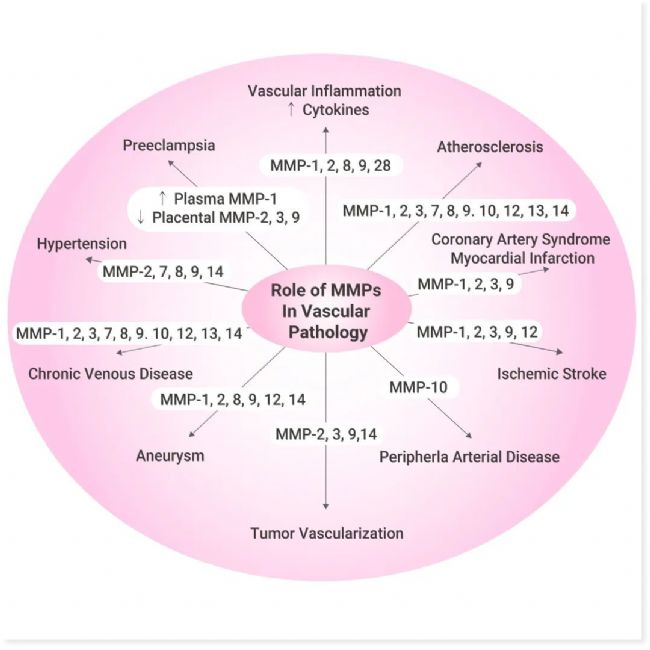 图 4. MMPs 在血管病理学中的作用[1]。