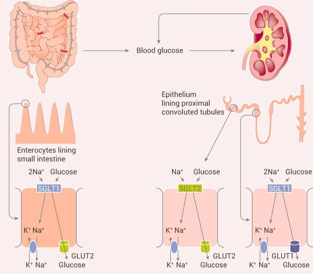 图 3. SGLT2 作用机制[12]