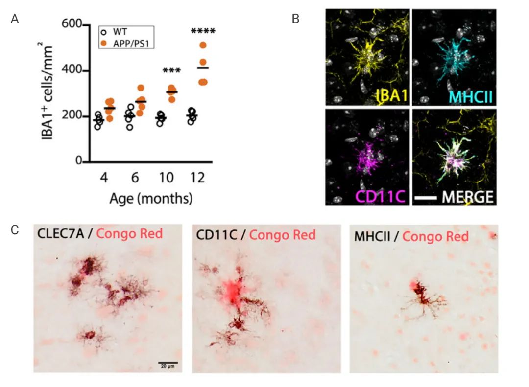 图 4. APP/PS1 模型小鼠的 DAM 的变化[4] A. 不同年龄的 APP/PS1 模型小鼠小胶质细胞数目的变化 B. IBA 与 MHCII CD11C 的荧光共定位 C. DAM 的表达增多伴随致密斑块数目的增多