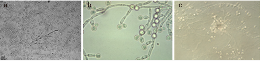 图 4. 酵母，青霉素等在光学显微镜下的外观[3]