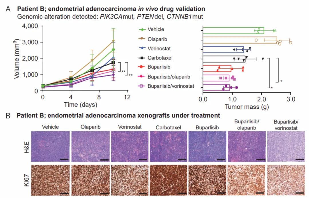 图 3. 单一或组合治疗对小鼠子宫内膜肿瘤生长的影响[2] A. 不同药物治疗对肿瘤体积和质量的影响。B. H&E染色切片和增殖标志物 Ki67 的 IHC