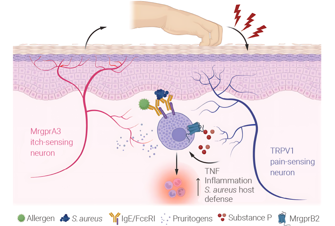 图 8. 抓挠与肥大细胞 FcεRI 的激活协同作用，引发过敏性皮肤炎症[2]。