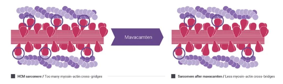 图 5. Mavacamten 的作用机制[9]