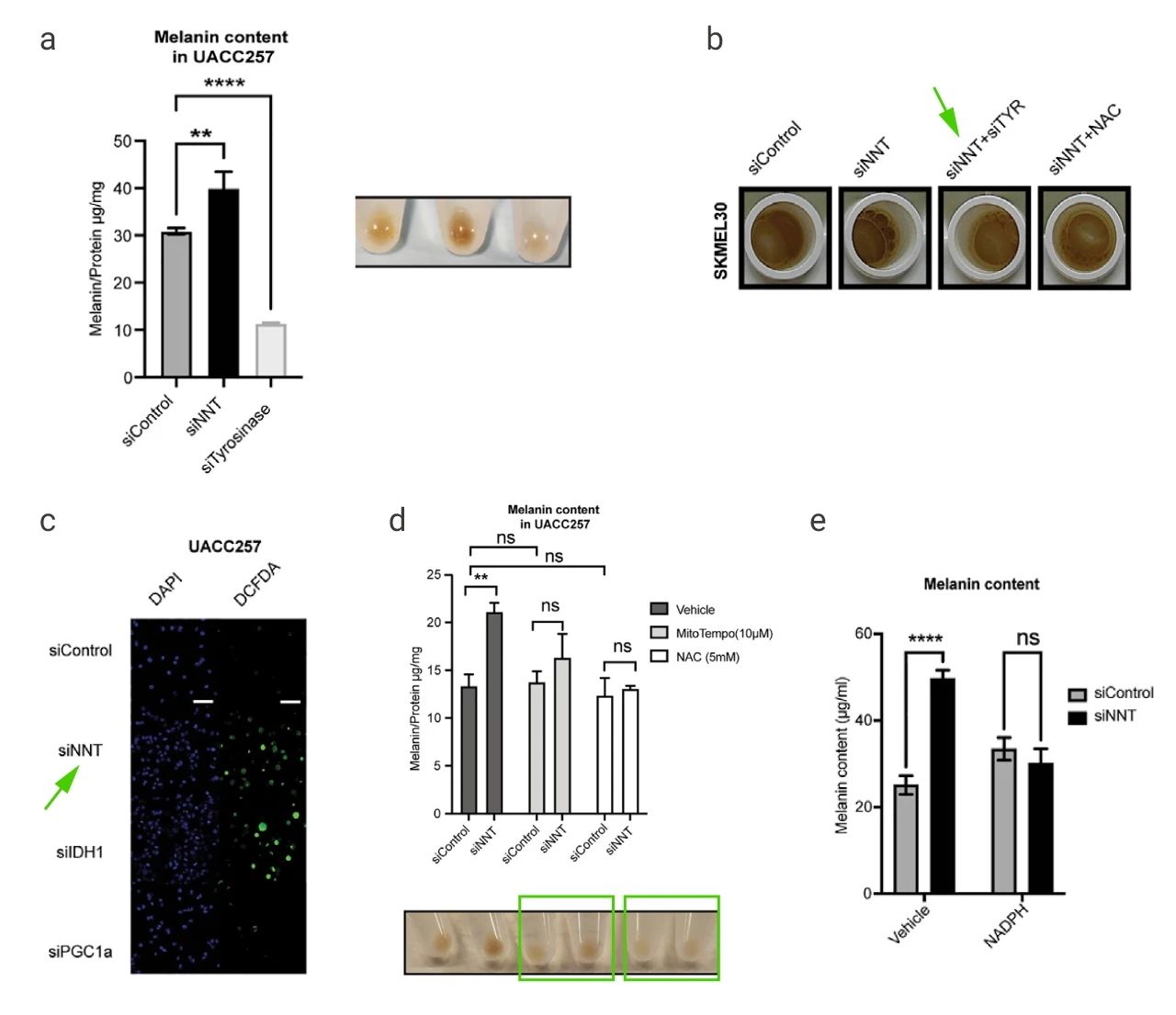 图 3. NNT 敲低导致黑色素含量增加 a: siNNT 增加 UACC257 细胞的色素沉着; b: 酪氨酸酶敲低对 siNNT 色素沉着的影响; c:  siNNT 处理后 UACC257 细胞中的 ROS 的变化; d-e: NAC 或 MitoTEMPO 处理 siNNT 诱导的人 UACC257 黑色素瘤细胞