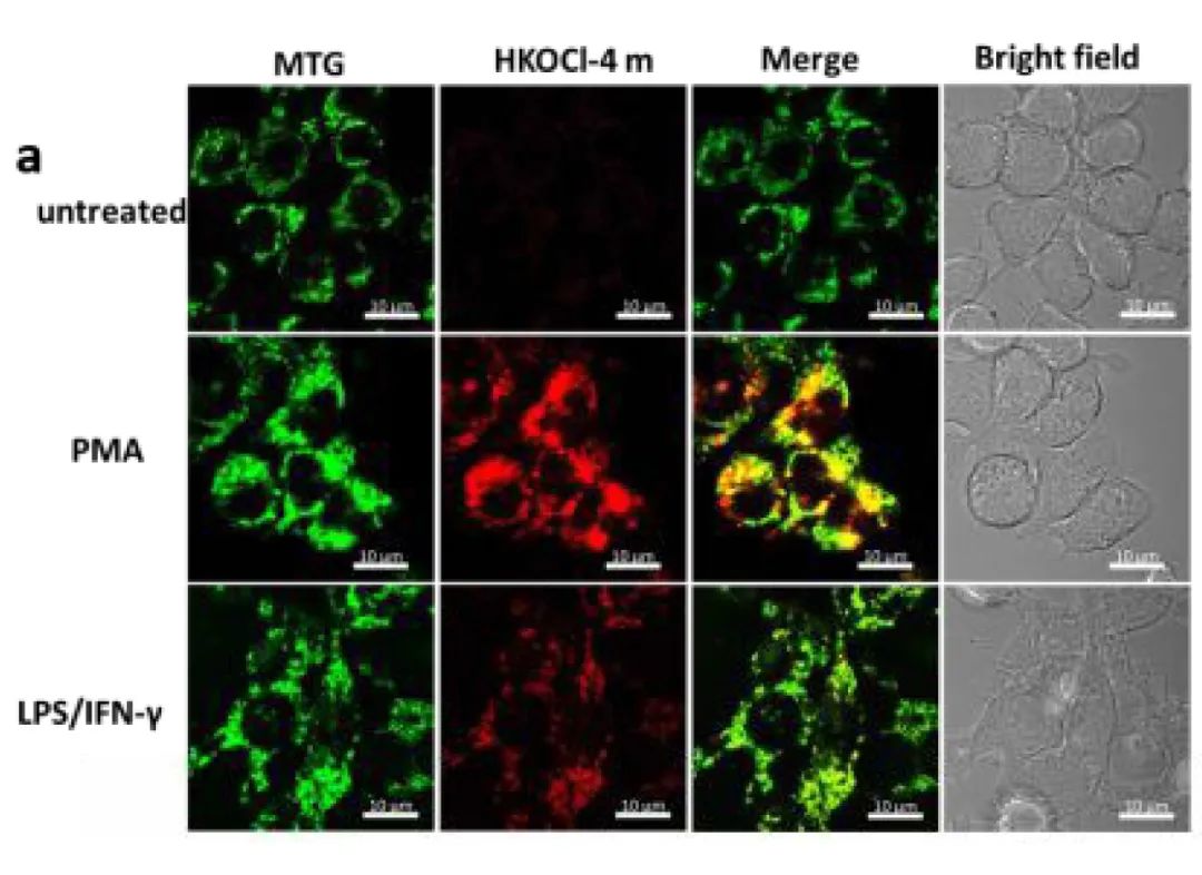 图 3. HKOCl-4m 对线粒体 HOCl 的共聚焦荧光成像[3]