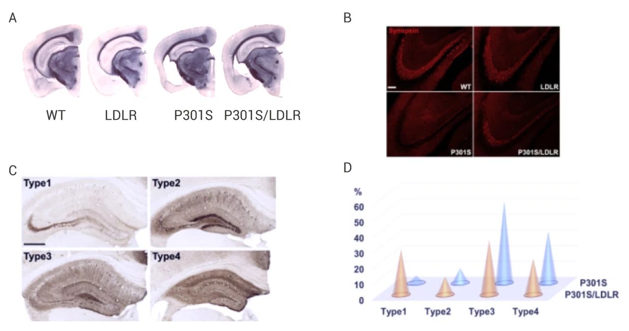图 5. P301S 小鼠中的 LDLR OX 减轻神经变性[6] A: 苏丹黑染色；B: 突触蛋白染色；C: AT8 染色的四种不同的 p-tau 模式；D. P301S和 P301S/LDLR 小鼠 p-tau 染色模式分布式