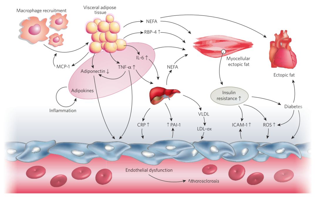 图 1. 肥胖及糖尿病与心血管疾病的关系[2]