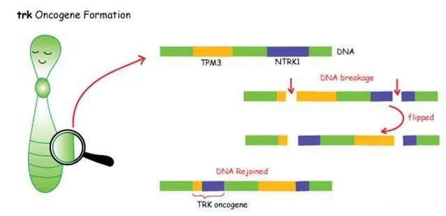 图1.TRK fusion