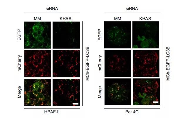 Figure 1.KRAS 抑制增加 KRAS 突变 PDAC 细胞系的自噬通量
