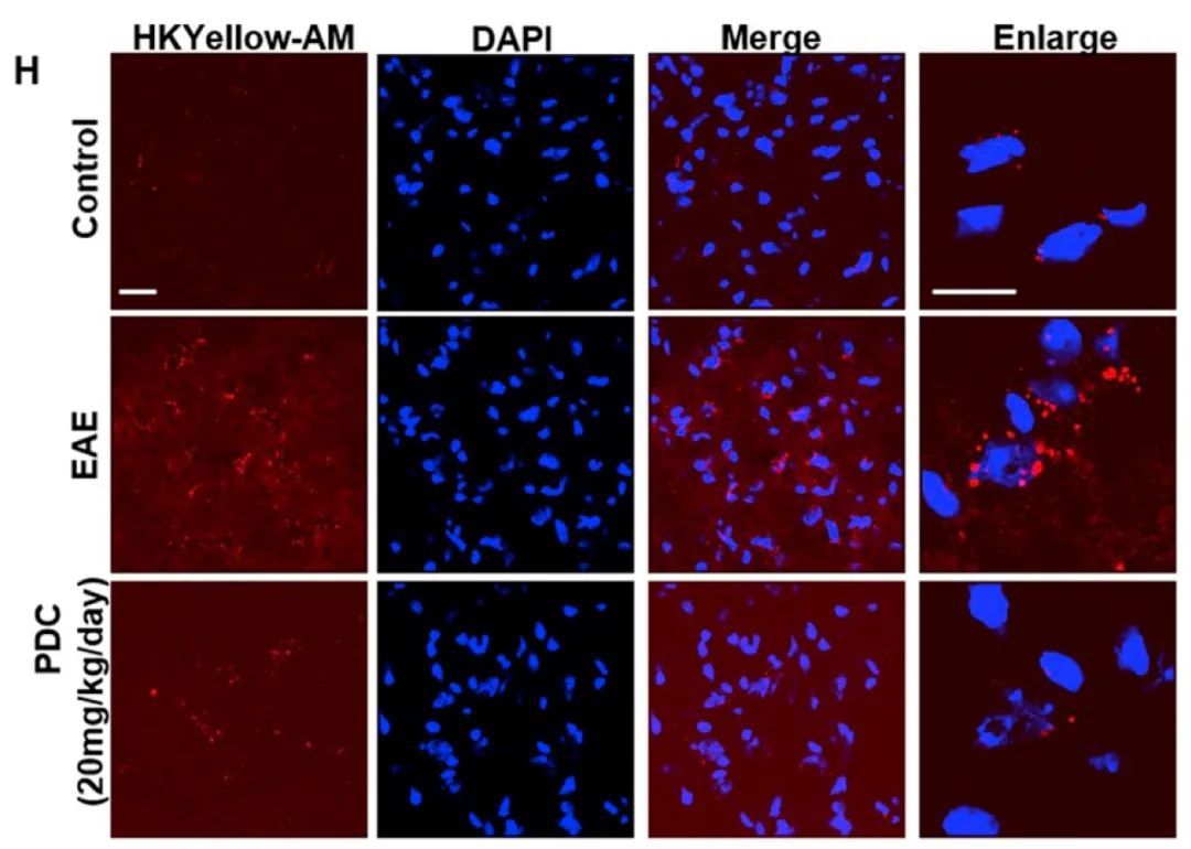 图 4. 免疫 EAE 或 PDC 处理的 EAE 小鼠脊髓灰质中 HKYellow-AM 的免疫荧光染色[4]