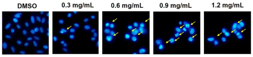 图 4. PC-3 细胞凋亡过程中核染色质的形态学变化[3]