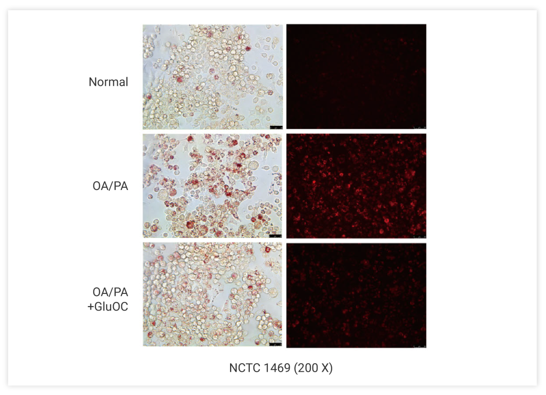 图 4. Nile Red 染色染色来监测 GluOC 处理后的细胞内脂滴[12]