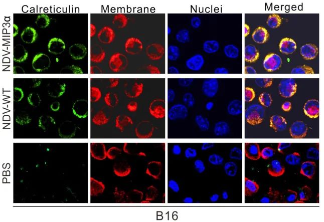 图 5. 三种探针复染确定 Ecto-CRT 易位至细胞表面[3]