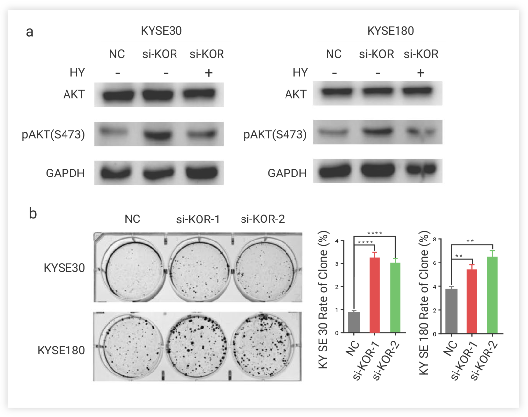 图 3. AKT 激酶抑制可以逆转 KOR 的抑制对细胞增殖、侵袭和迁移的影响[1]