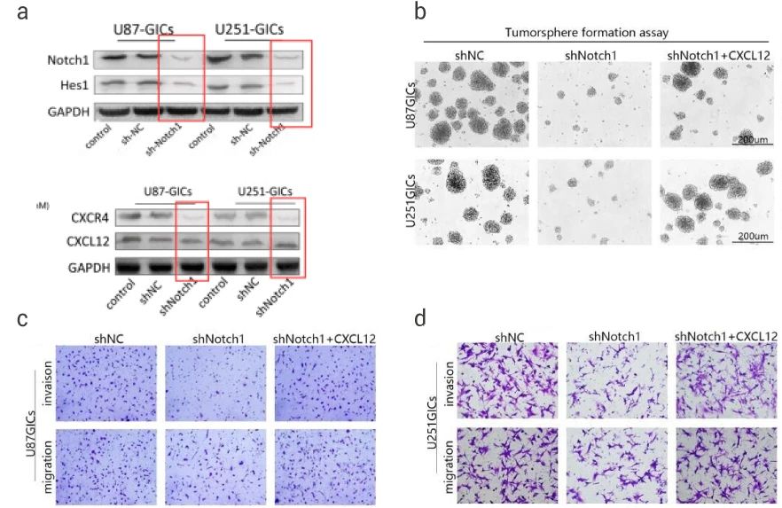 图 5. a. 建立稳定的 shNotch1 细胞系；b. 肿瘤球形成实验；c-d. 肿瘤细胞侵袭和迁移实验[4]