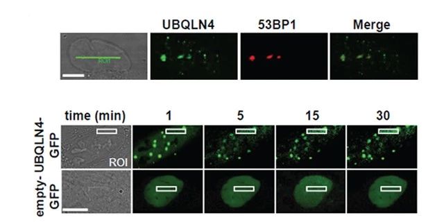 图 3. UBQLN4 被招募到DNA损伤位点