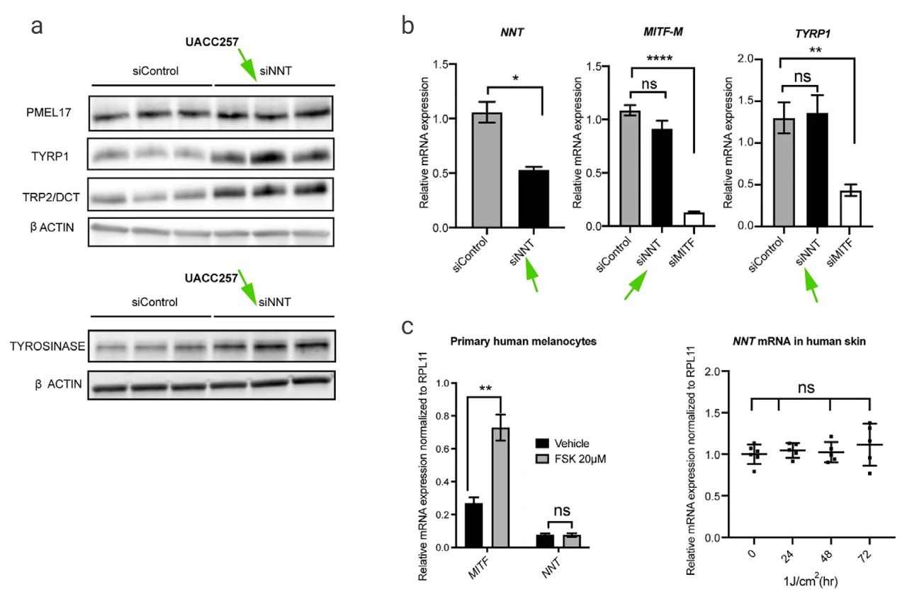 图 4. NNT 介导的色素沉着机制 a: siNNT 处理 72 小时后 UACC257 黑色素瘤细胞的酪氨酸酶、DCT/TRP2 和 TYRP1 的表达; b: siRNA 转染后 NNT、mMITF 和 TYRP1 的 qRT-PCR 分析; c: Forskolin 处理黑色素瘤细胞和皮肤组织