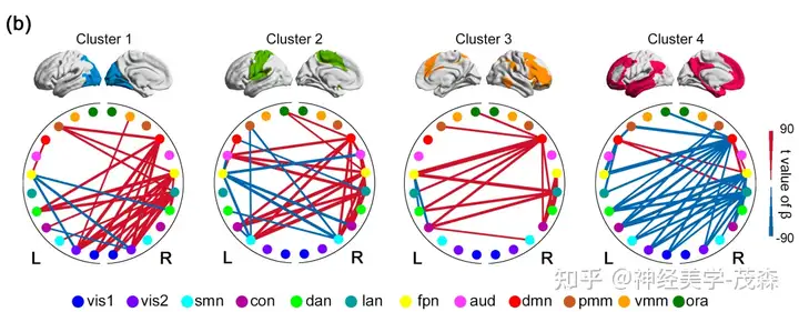 音乐的喜怒哀乐,大脑如何“分工”感受?