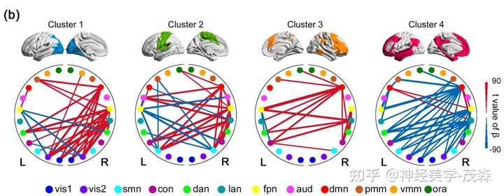 音乐的喜怒哀乐,大脑如何“分工”感受?