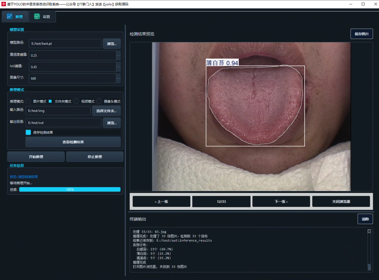 image-20250801140427259