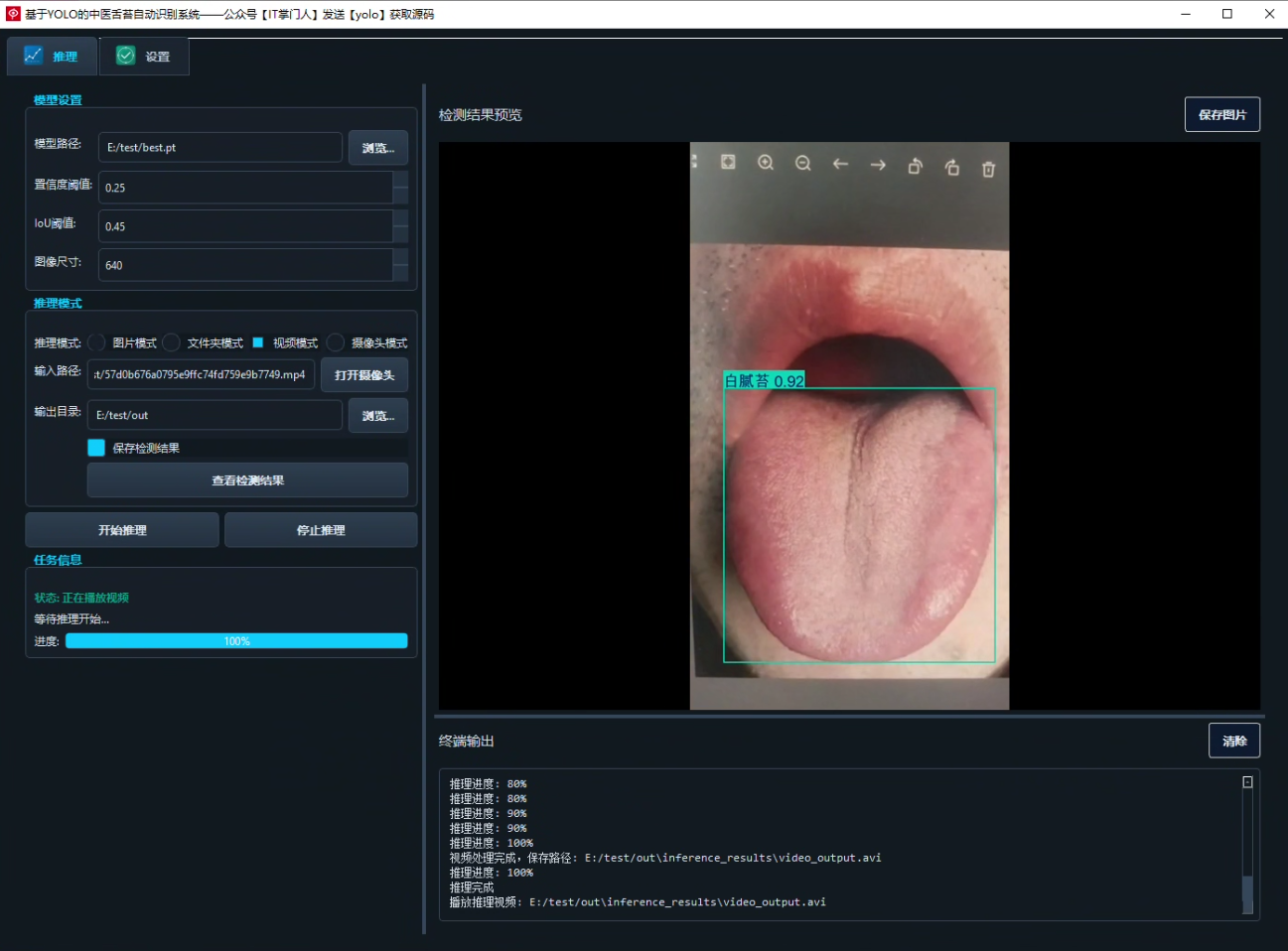 image-20250801140832217