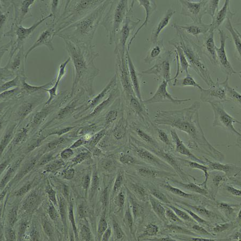 人肝星状细胞(Hepatic Stellate Cells, HSCs)
